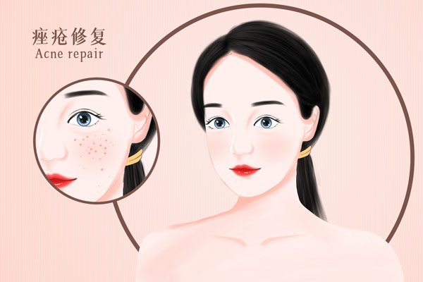 摄图网_401860698_banner_医美之痤疮修复插画（企业商用）.jpg