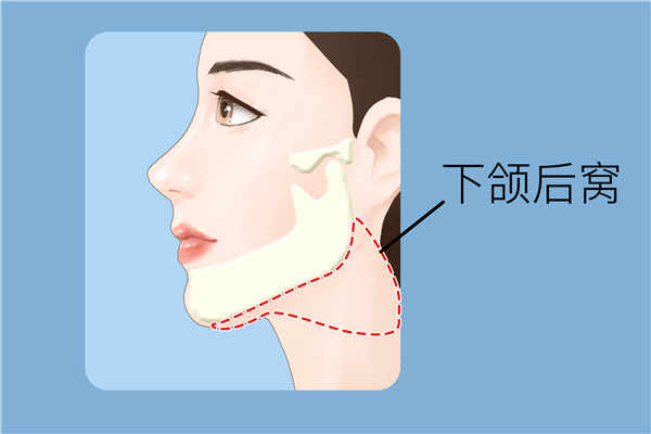 如何减掉双下巴妙招