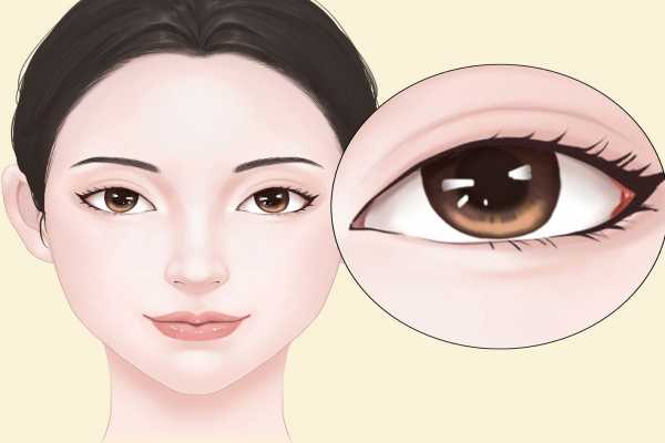 眼屈光手术是什么意思 什么是眼屈光手术