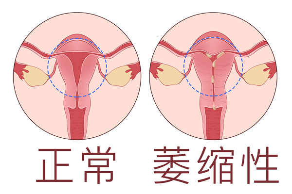 宫缩是什么感觉的