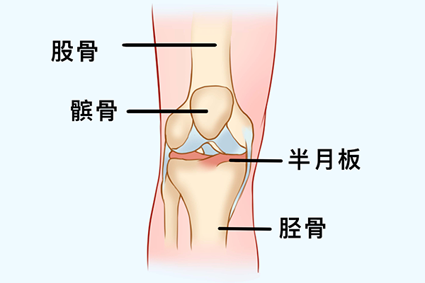 吹空调膝盖疼是风湿吗